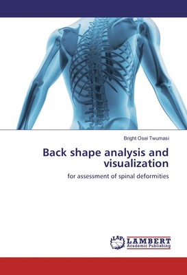 Bright Osei Twumasi | Back shape analysis and visualization | Taschenbuch (2017)