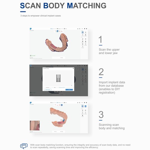 Dental Intra-Oral 3D Scanner CAD/CAM Scanning Machine with Software ...