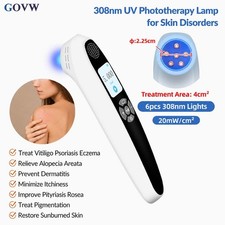308nm UVB Light Therapy Device 6 Diodes LCD Rechargeable Portable Home Skin Care