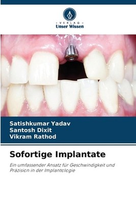 Sofortige Implantate by Satishkumar Yadav (German) Paperback Book