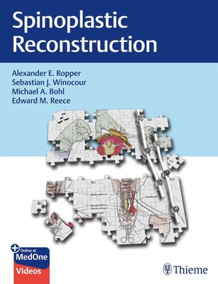 Alexander Ropper (u. a.) | Spinoplastic Reconstruction | Bundle | Englisch
