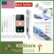 USB Blackhead Remover With LED Camera & 6 Suction Heads – Effortless Skincare