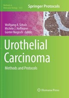 Wolfgang A Schulz (U. A.) | Urothelial Carcinoma | Taschenbuch | Englisch (2018)