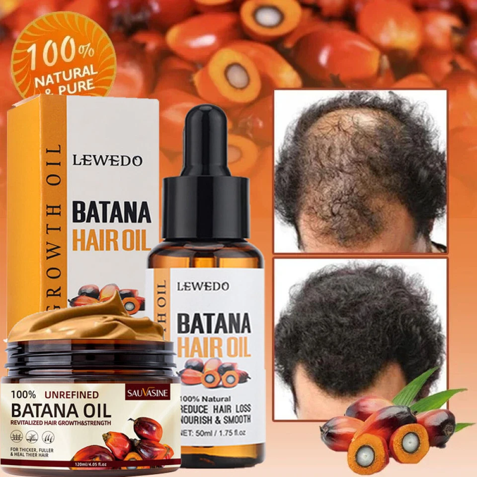 6/3x Batana Oil Serum,Organic&Natural Batana Oil for Hair Growth,Anti Hair Loss - Image 3 of 4