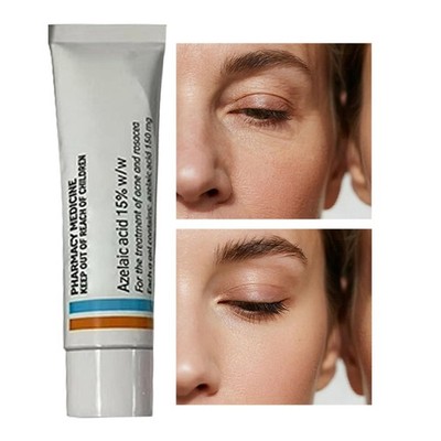 sunroi ointment glutathione cream 15% Azelaic Acid Acne Treatment Gel 30g Anti-Blemish Glow Soap
