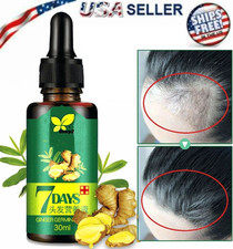 The Best Hair Loss Treatment For Men And Women Regrow Hair Regrowth Natural For Sale Online Ebay