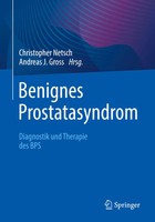 Christopher Netsch (U. A.) | Benignes Prostatasyndrom | Taschenbuch | Deutsch