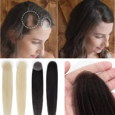 RICH-CHOICES UK Human Hair Patches Pieces Full Skin Base Cover Bald Spots for Alopecia Areata