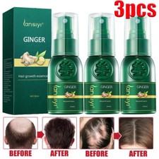 3PCS Natural Herbal Hair Growth Essence Spray Anti Hair Loss Fast Grow Serum 30g