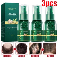 3PCS Natural Herbal Hair Growth Essence Spray Anti Hair Loss Fast Grow Serum 30g