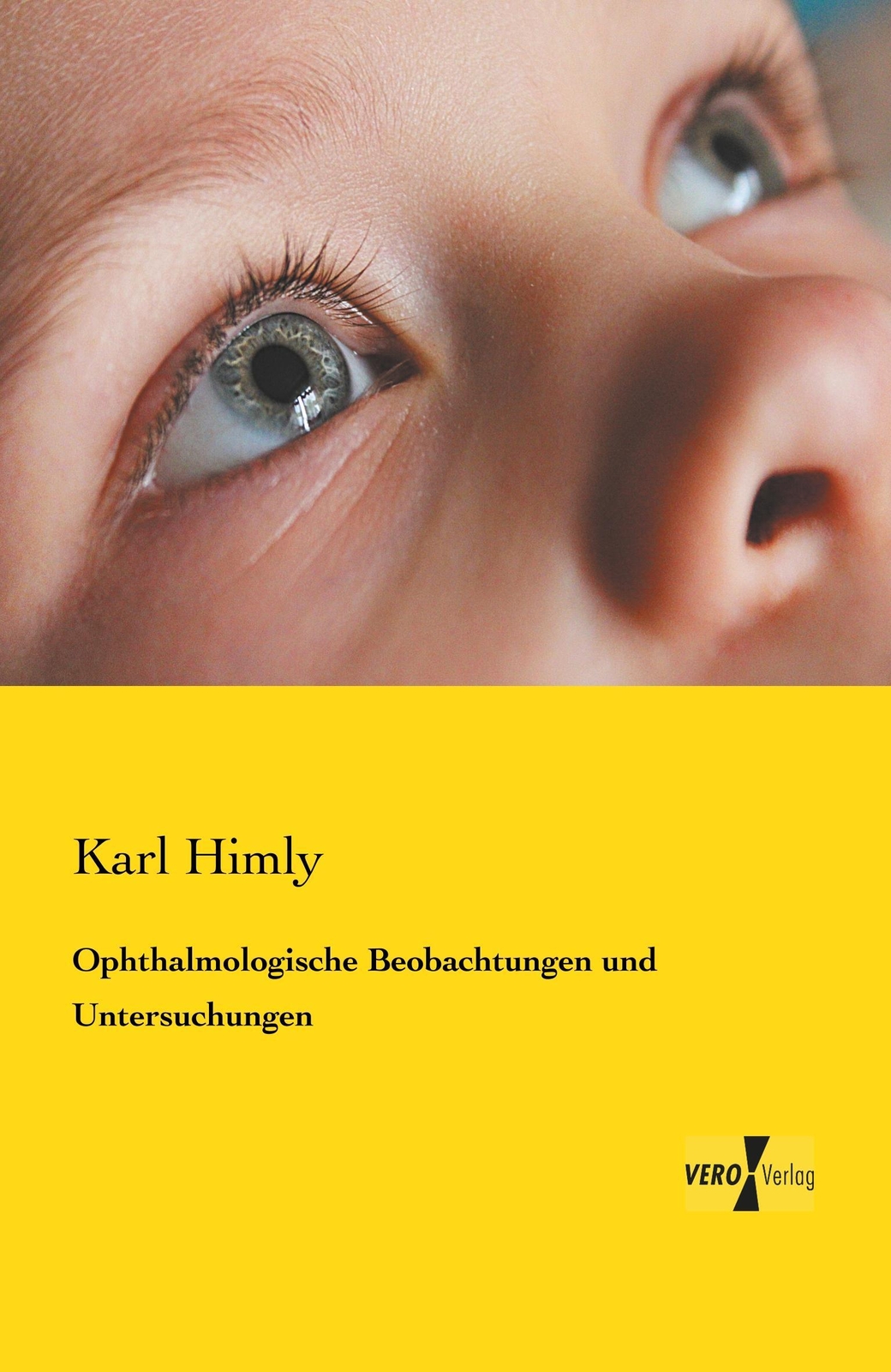 Thumbnail - Karl Himly | Ophthalmologische Beobachtungen Und Untersuchungen |