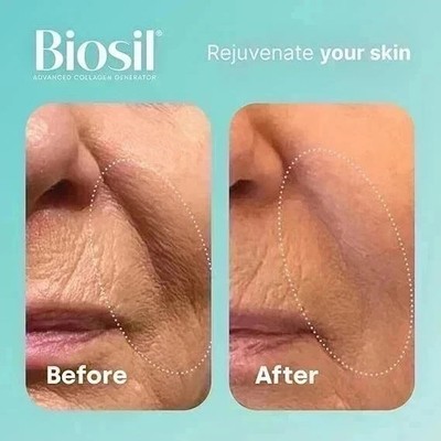 Biosil Collagen Generator - 120 Original Capsules ( pack of 2 )