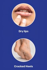 Sebolin - The Complete Skincare  (15GRAMS pack of 2;30g) Famous Indian Skin Care