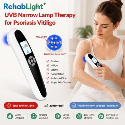 308nm Excimer Home UVB Phototherapy Device DC Charging Ultraviolet Light Wand