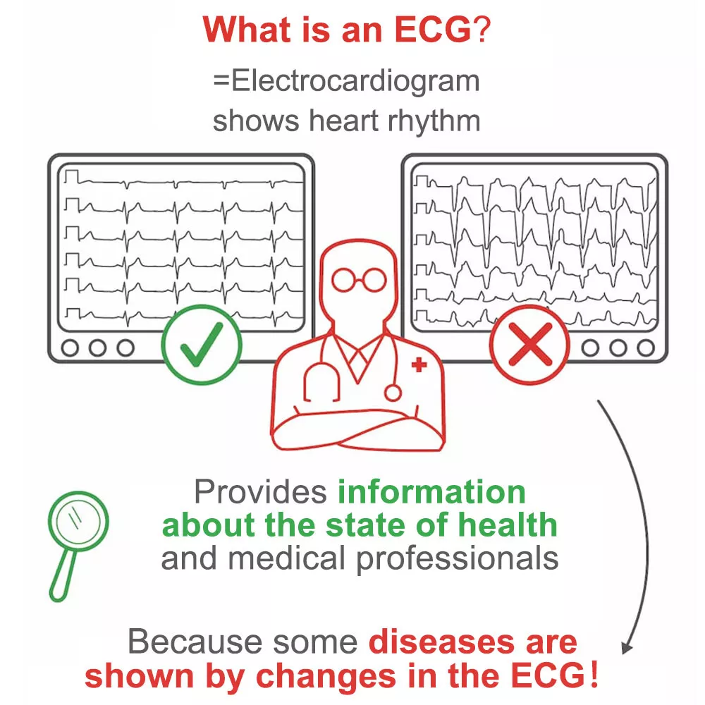 12 Lead ECG/EKG Machine w Interpretation Electrocardiograph Auto-analysed  Result 700721208685