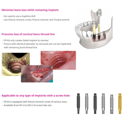 Implant Fractured & Fixture Screw Removal Kit Extractor Drills Neobiotech SR FR - Picture 73 of 83