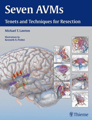 Seven AVMs: Tenets and Techniques for Resection by Michael T. Lawton (English) H