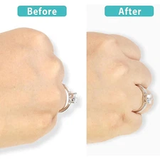  R-ing Size Adjuster R-ing Sizer Spacer Guard 8 Sizes For Loose ANYO