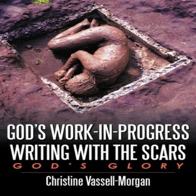God's Work-in-Progress Writing with the Scars God's Glory Christi