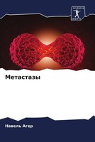 Nawel' Ager | Metastazy | Taschenbuch | Russisch (2023) | Sciencia Scripts