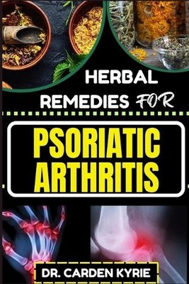 Carden Kyrie Herbal Remedies for Psoriatic Arthritis (Taschenbuch) (US IMPORT)