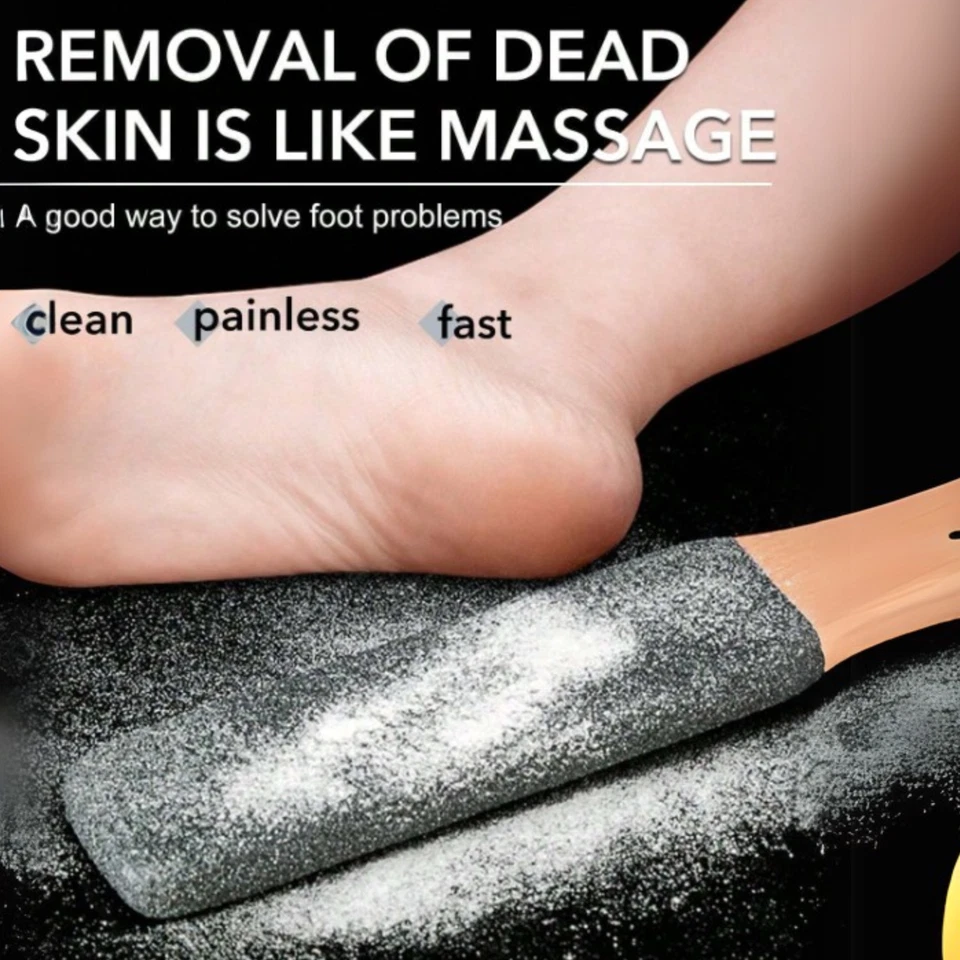 Professional Pedicure Rasp Foot File Callus Remover for Dead Skin & Cracked Heel - Image 3 of 4