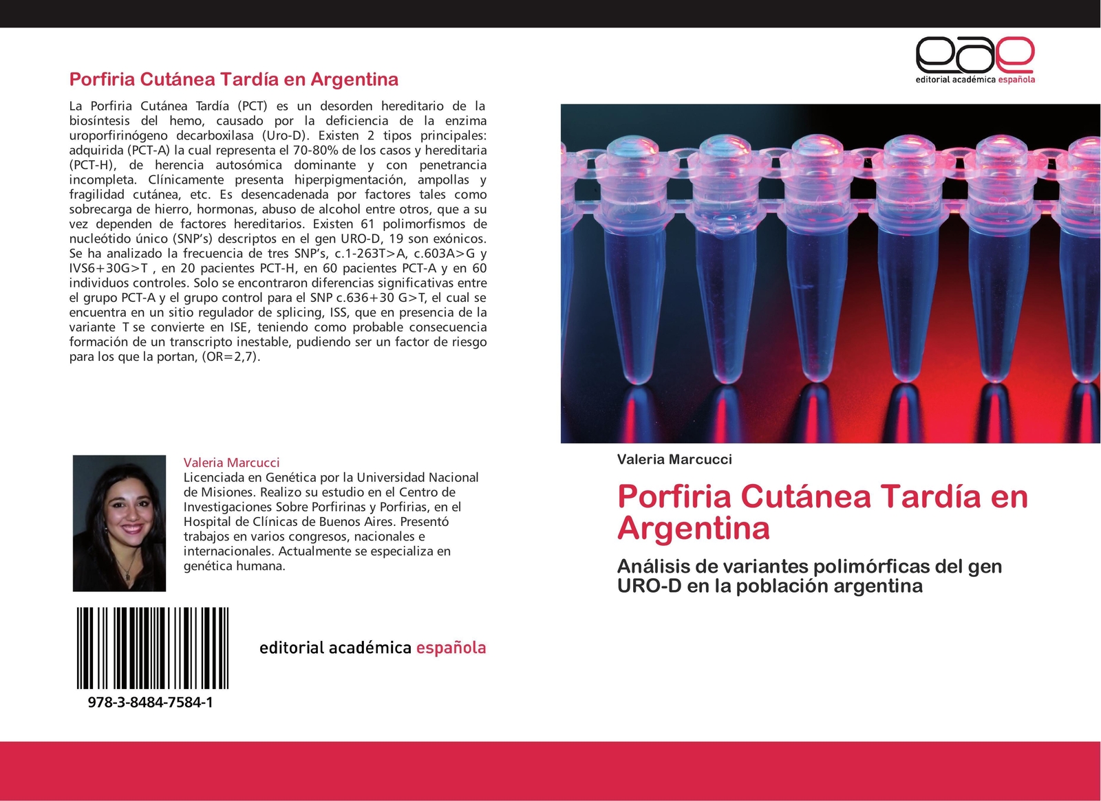 Thumbnail - Valeria Marcucci | Porfiria Cutánea Tardía En Argentina | Taschenbuch
