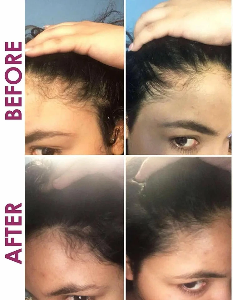 Sorrel Hair Drops Loss Treatment Edge Growth Serum Dropper 4oz. - Image 3 of 4