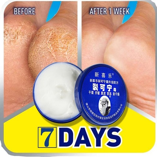 Herbal Anti Crack Foot Cream Oil Anti-Drying Moisturizing Feet Cream 85g - Picture 2 of 5