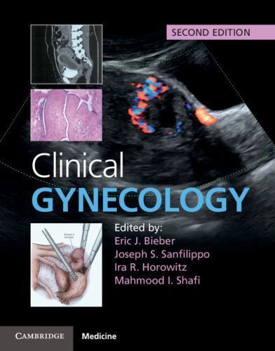 Clinical Gynecology, 2e Hardcover Cambridge University Press 9781107040397 LN