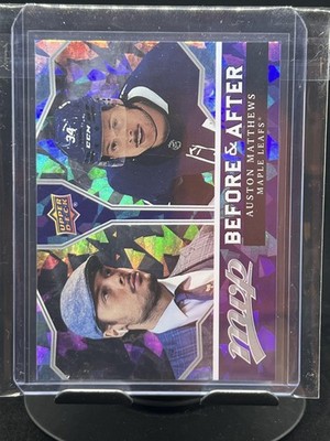 2021-22 Upper Deck MVP #BA-1 Auston Matthews Before and After