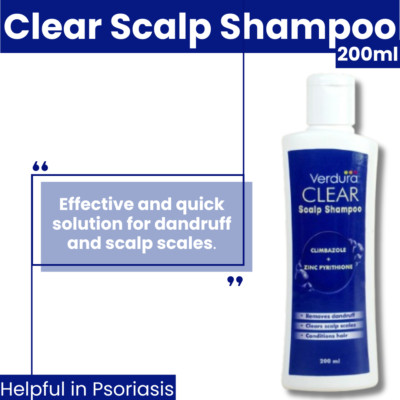 Psoriasis & Eczema Shampoo 200ml   Soothing Treatment for Scalp Relief