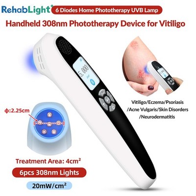 308nm Excimer Lamp Phototherapy Device with 6 Diodes & 2.25x2.25cm Light Window