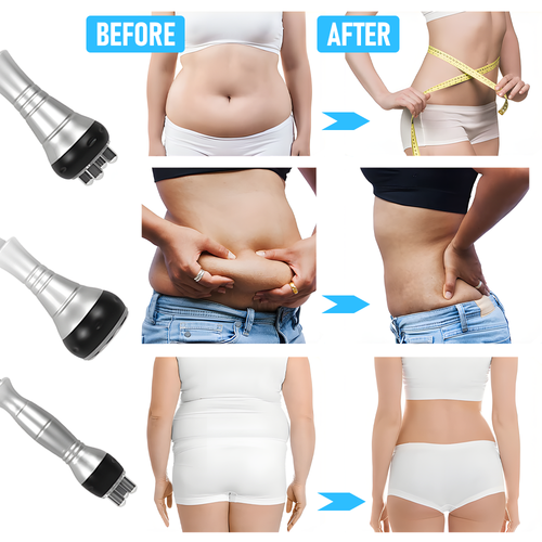 Ultrasonic Cavitation Machine 3in1 40K RF Radio Frequency Body Slimming Machine - Picture 6 of 8