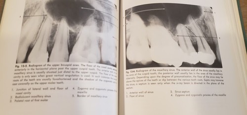 Dental Radiology Third Edition by Wuehrmann and Manson-Hing -1973 - Picture 7 of 7