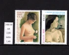 Breast Diseases
