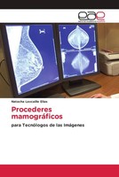 Natacha Lescaille Elias | Procederes MamográFicos | Taschenbuch | Spanisch