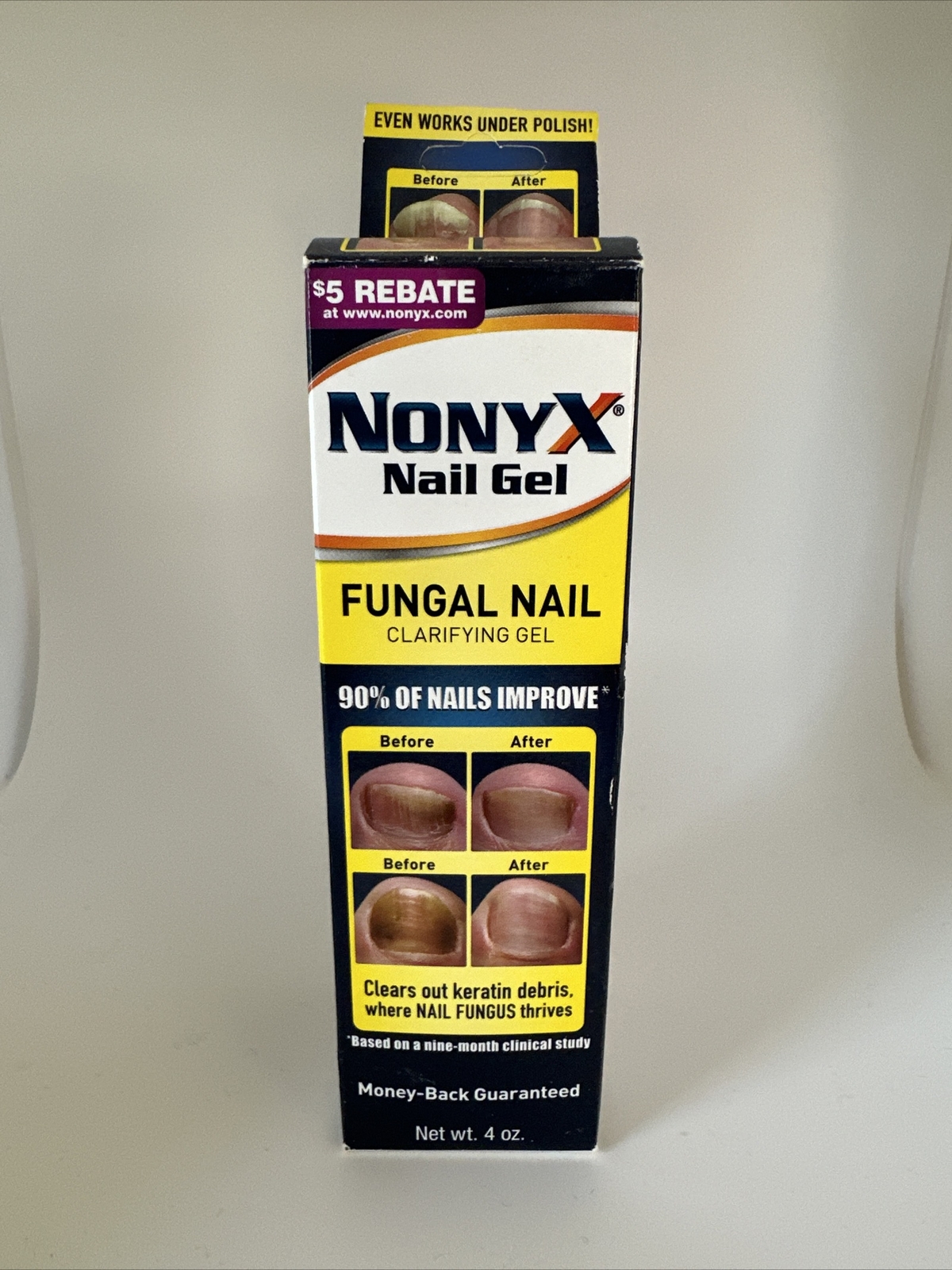 Nonyx Fungal Nail Clarifying Gel, a Toenail Fungus Treatment that
