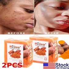 2× Tumeric Soap Skin Whitening Dark Spots lightening Acne Brightening Turmeric