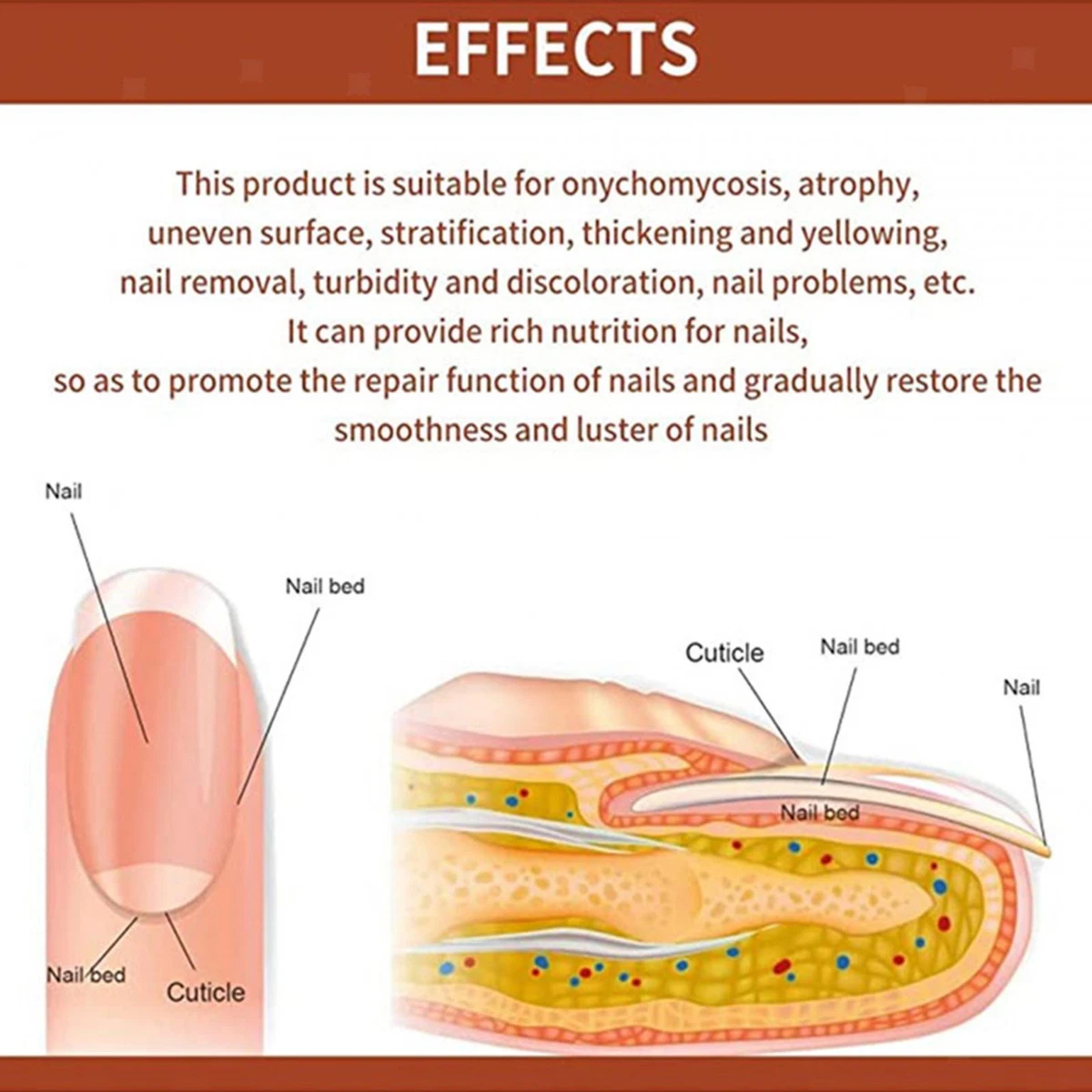 Share more than 127 damaged nail bed repair super hot ceg.edu.vn