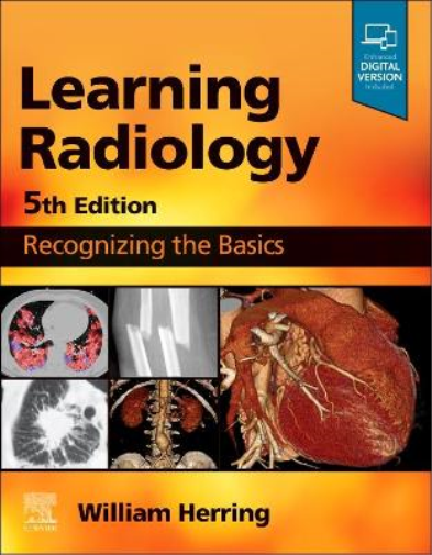 William Herring Learning Radiology (Tascabile)