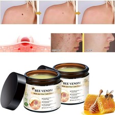 Bee Venom Skin Tag Removal Treatment Cream Body Care Mole Corn Wart Remover