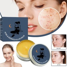 Acne  Redness Killer Balm Skin Care Cream Deeply Cleanses HOT