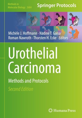 Michèle J. Hoffmann (u. a.) | Urothelial Carcinoma | Buch | Englisch (2023) | xi