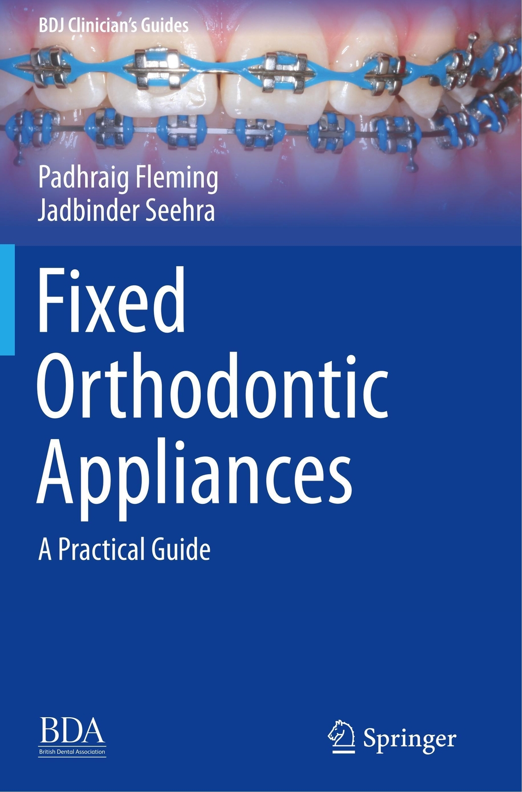 Thumbnail - Fixed Orthodontic Appliances | A Practical Guide | Jadbinder Seehra