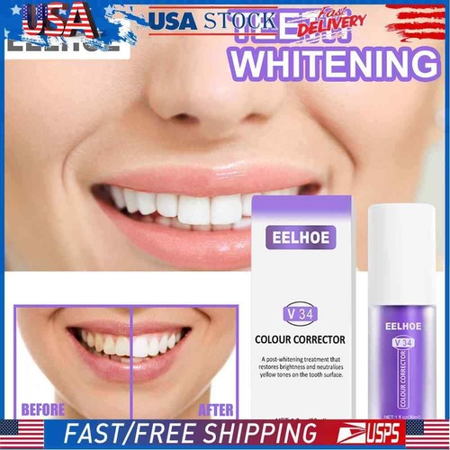 v34 whitening