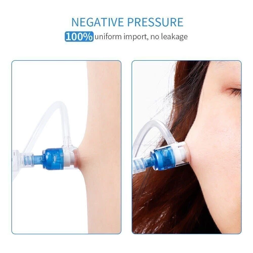 Mesotherapie Pistole Gerät Hydrolifting Waffe EZ Unterdruck Meso Wasserinjektor - Bild 6 von 13