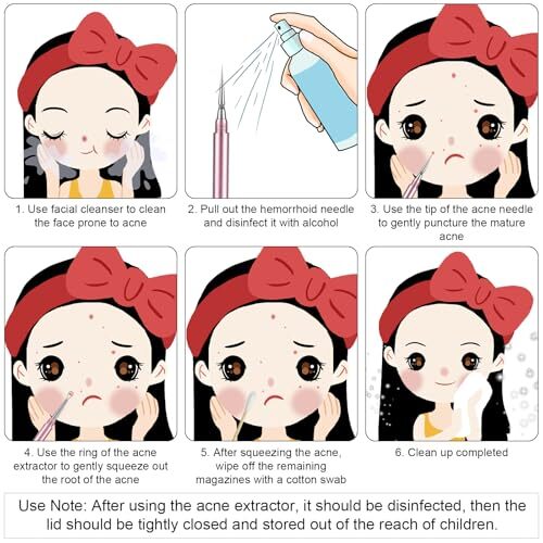 Blackhead Extractor, Metal 2 in 1 Acne Clean Needle Professional Pimple Popper - Bild 5 von 7