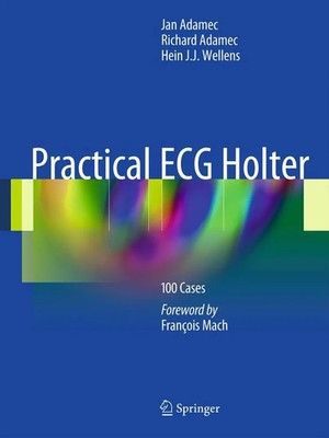 Practical ECG Holter 100 Cases Jan Adamec (u. a.) Taschenbuch xvi Englisch 2011