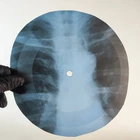LED ZEPPELIN THANK YOU X-Ray USSR Record Roentgen Bone Ribs Music Vinyl